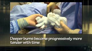 Burn Center Wound Care-UF Department of Surgery