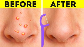 Unpredictable Beauty Hacks That Actually Work!
