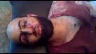 18+ not for shock! Aleppo: The fate of every foreign terrorist in Syria.