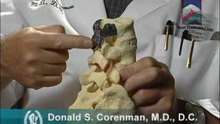 What is Degenerative Spondylolisthesis? | Spine Instability | Orthopedic Spine Surgeon in Colorado