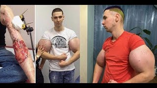 Russian Synthol Freak  !