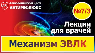 Лазерная коагуляция вен - механизм ЭВЛК 7. Перфорация вен при ЭВЛО - часть 3