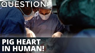 Maryland doctors transfer pig heart to human patient