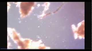 'HAARP' Chemtrails ~ Why MY TOWN is PLAGUED By Illness RIGHT NOW !!!