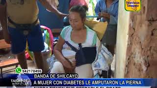 TARAPOTO NOTICIAS: A MUJER CON DIABETES LE AMPUTARON LA PIERNA AHORA TIENEN QUE OPERARLE EL BRAZO.