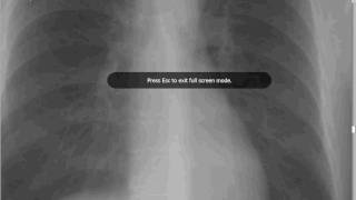 DICOM Viewer