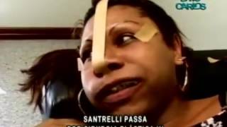 Rochele Santrelly passa por cirurgia plástica