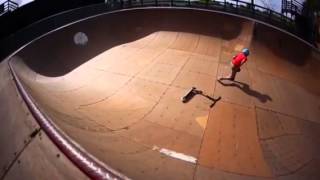 Scooter Faceplant Fail!