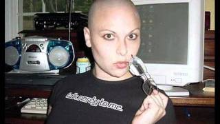 132 Bald Beauties