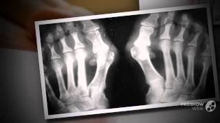 valgus pro отзывы

  - Вальгус про недорого купить.