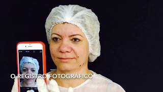 Fios de Sustentação Facial