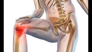 Лечение коленных суставов гимнастикой  Бубновский