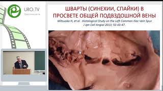 Двустороннее варикоцеле и варикозная болезнь вен органов малого таза.