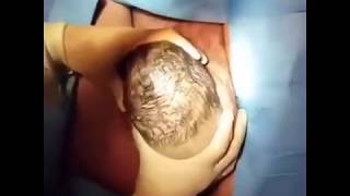 Woman giving Birth to her first Child