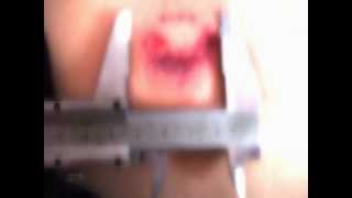 Omerta T tested in humans