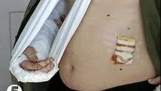 [NTU] Мнение студента о трагедии в Харькове. Поножовщина. Июнь 2015.. украина новости сегодня