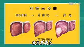 【志為人醫守護愛】20180228 - C肝新藥 黑白人生變彩色