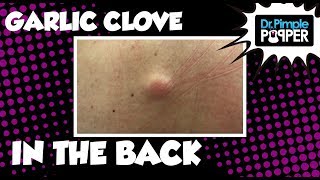 Garlic Clove Hiding in the Back
