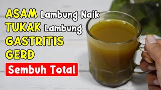 BENAR-BENAR BIKIN KAGET! ASAM LAMBUNG, TUKAK LAMBUNG, SAKIT MAAG, SEMBUH SEKETIKA || SEHAT TUBE