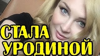ПЫНЗАРЬ ПЕРЕКАЧАЛА БОТОКС! НОВОСТИ 01.03.2017