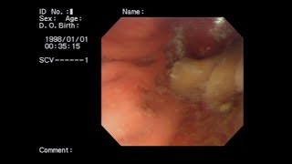 Inside stomach vore
