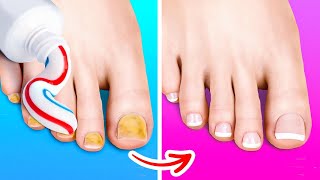 Awesome Hacks Every Girl Should Know || Pedicure, Beauty hacks, Hair tips