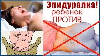 Шок! Эпидуральная анестезия усиливает боль ребенка в родах!  Позиция психолога