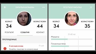 КОЖА ПОМОЛОДЕЛА НА 9 ЛЕТ !!!