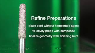 e.max Crown Preparation
