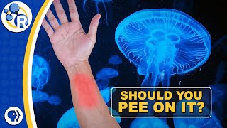 Does Peeing on a Jellyfish Sting Make it Stop Hurting?