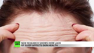 What happens to your face when you don’t sleep?