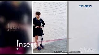 Amputee girl also an aspiring disabled model