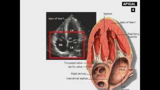 Echocardiography Introduction.