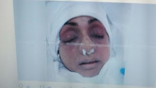 Sridevi: Last image of Bollywood actress after embalming surfaces on social media | Oneindia News