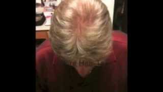 Hair-Tek
