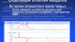 Режимы ИВЛ 8. BIPAP APRV BiLevel и др.