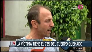 Prendió fuego a su pareja con alcohol: la víctima tiene el 75% del cuerpo quemado