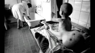 Chernobyl legacy.Paul Fusco