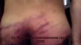 Пытки заключенных в тюрьме №1 Винница, Украина, 21/08/2009