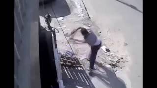 КАК НЕ НУЖНО ДЕРЖАТЬ ЦИРКУЛЯРКУ. Отрезало пальцы