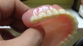 denture  Зубные протезы с замками и фрезеровкой