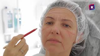 14 выпуск. "Преображение с VIP Clinic". Филлеры + ботулинотерапия.