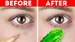 Skincare Hacks To Feel Gorgeous || Natural Beauty Hacks And Tips