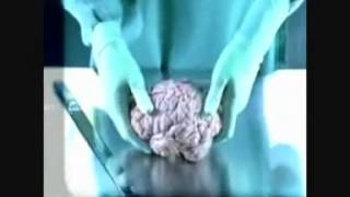 How Somking Damage - Brain! / كيف يضرك التدخين - المخ