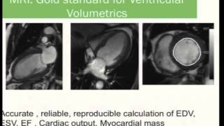 7_6 Dr Mona Bhatia on Cardiac MRI: Promise, Hope or Hype at WCCPCI 2014