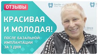 Протезирование всех зубов на 6 имплантах ? Отзыв пациента о технологии all-on-6