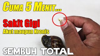 JANGAN BURU-BURU BELI OBA BEBAS, CUKUP TEMPELKAN INI SAKIT GIGI AKUT MAUPUN KRONIS SEMBUH SEKETIKA