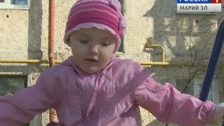 Каллиста Кудрявцева, 4 года, врожденный буллезный эпидермолиз