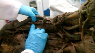 Anatomia - Brazo - Musculos