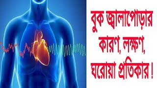 বুক জ্বালাপোড়ার কারণ, লক্ষণ, প্রতিকার এবং মুক্তির ঘরোয়া উপায় | How to Cure Acid Reflux Naturally